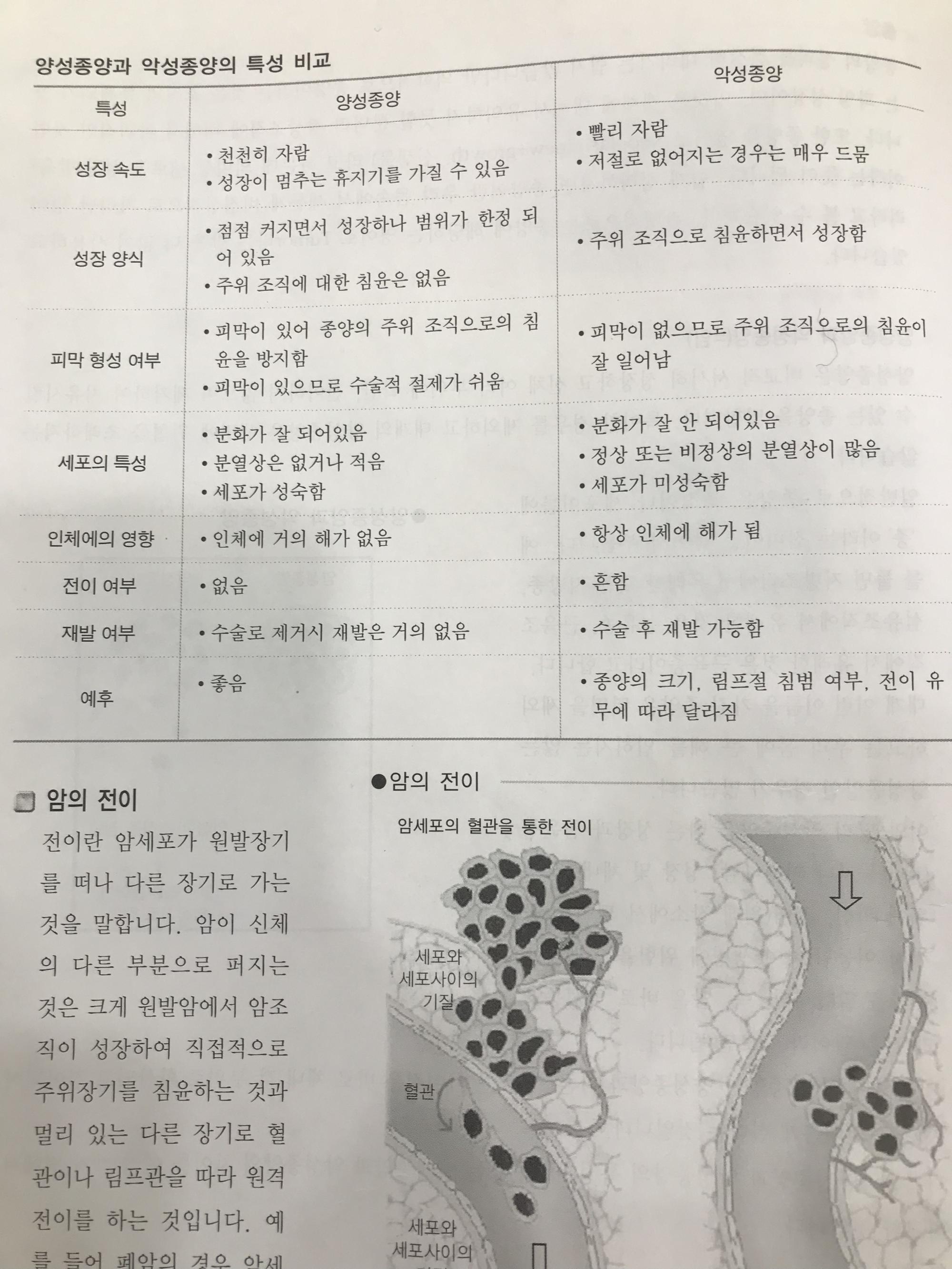 잇싸 - 양성종양과 악성종양